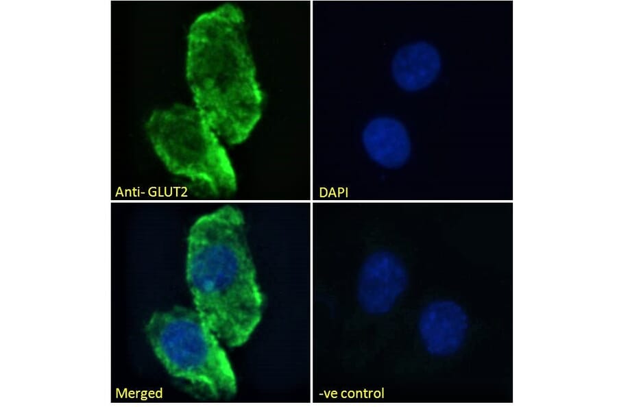 Immunofluorescence - Anti-Glucose Transporter GLUT2 Antibody (A326249) - Antibodies.com