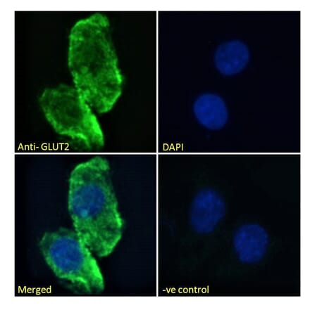 Immunofluorescence - Anti-Glucose Transporter GLUT2 Antibody (A326249) - Antibodies.com