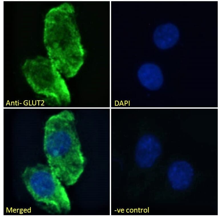 Immunofluorescence - Anti-Glucose Transporter GLUT2 Antibody (A326249) - Antibodies.com