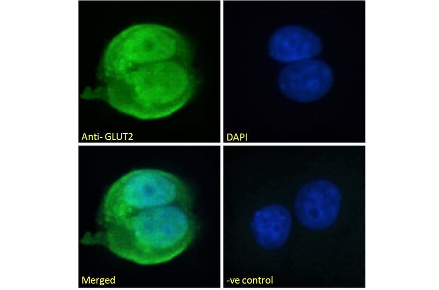Immunofluorescence - Anti-Glucose Transporter GLUT2 Antibody (A326249) - Antibodies.com