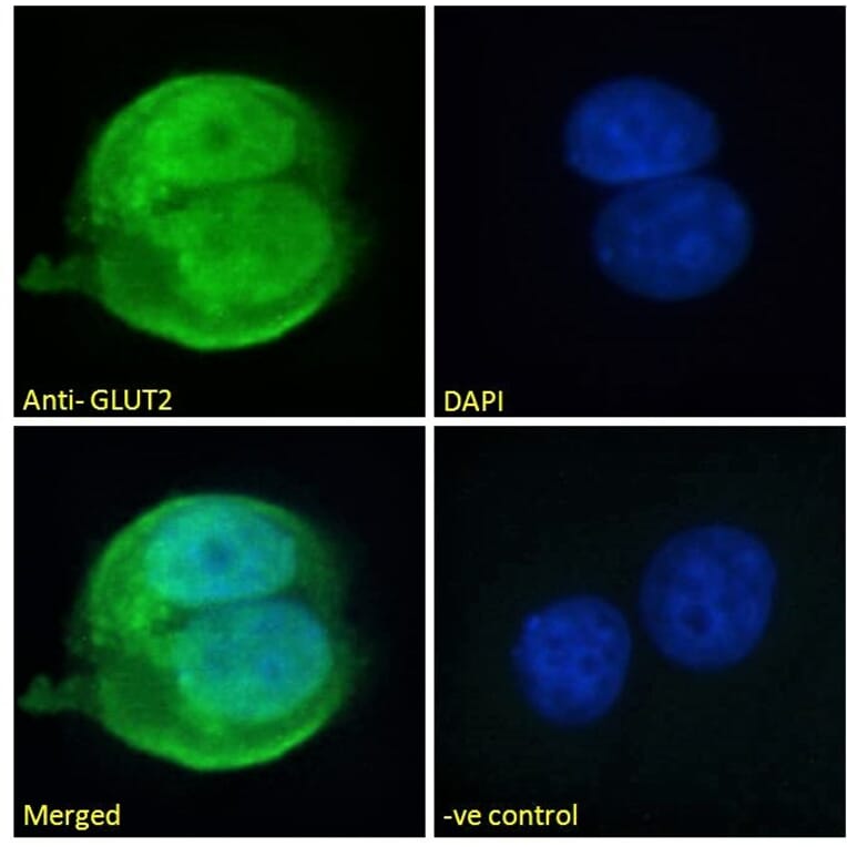 Immunofluorescence - Anti-Glucose Transporter GLUT2 Antibody (A326249) - Antibodies.com