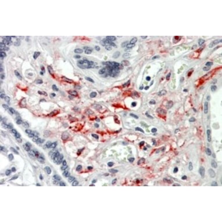 Immunohistochemistry - Anti-HCP1/PCFT Antibody (A326251) - Antibodies.com