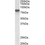 Western Blot - Anti-Hemopexin Antibody (A326252) - Antibodies.com