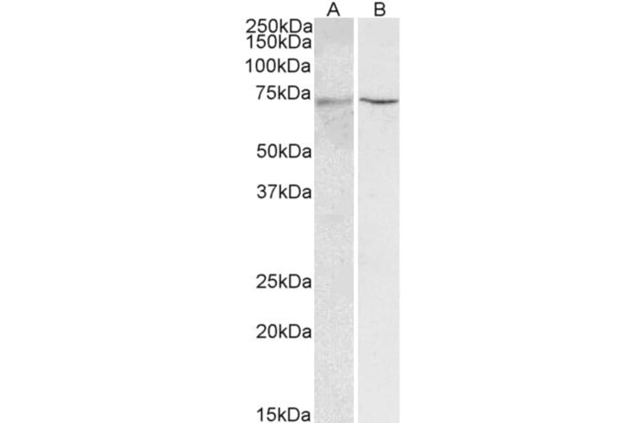 Western Blot - Anti-HNF1 alpha Antibody (A326253) - Antibodies.com