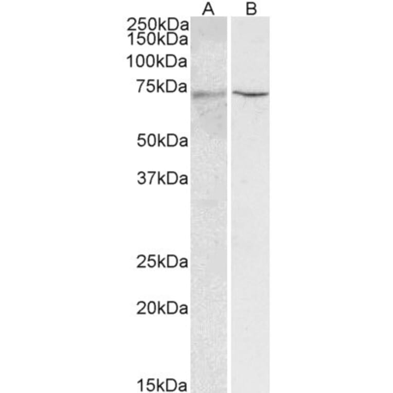Western Blot - Anti-HNF1 alpha Antibody (A326253) - Antibodies.com