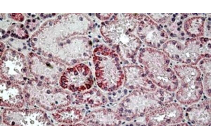 Immunohistochemistry - Anti-HYAL2 Antibody (A326254) - Antibodies.com