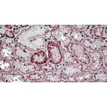 Immunohistochemistry - Anti-HYAL2 Antibody (A326254) - Antibodies.com