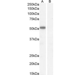Western Blot - Anti-IKZF4 Antibody (A326255) - Antibodies.com