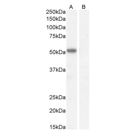 Western Blot - Anti-IKZF4 Antibody (A326255) - Antibodies.com