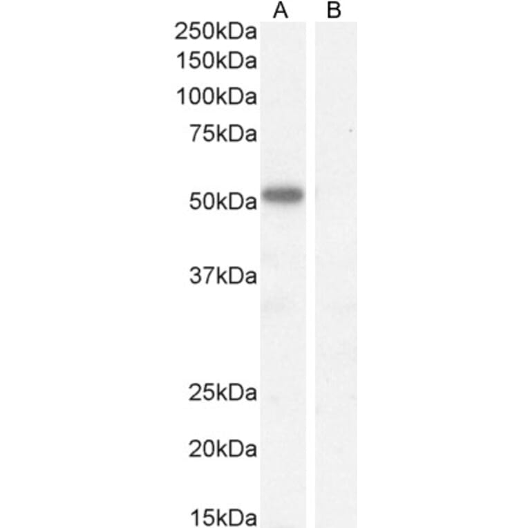 Western Blot - Anti-IKZF4 Antibody (A326255) - Antibodies.com