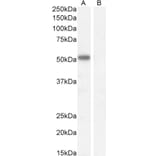 Western Blot - Anti-IKZF4 Antibody (A326255) - Antibodies.com