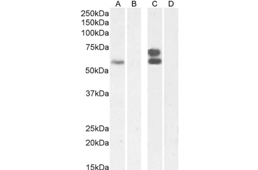 Western Blot - Anti-IKZF4 Antibody (A326255) - Antibodies.com