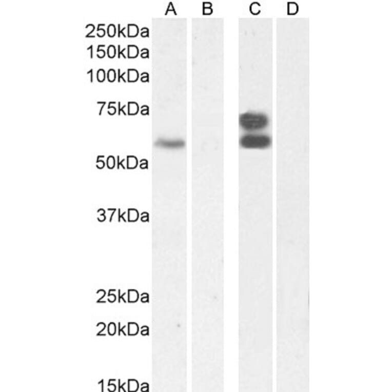 Western Blot - Anti-IKZF4 Antibody (A326255) - Antibodies.com