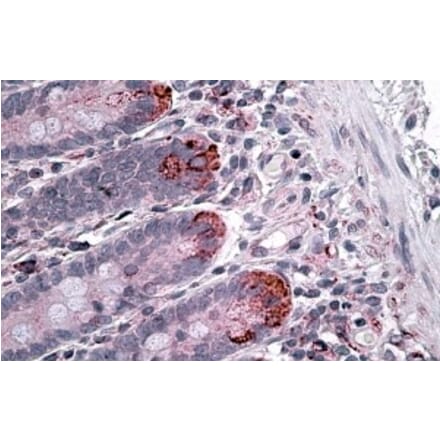 Immunohistochemistry - Anti-IL-12A Antibody (A326256) - Antibodies.com