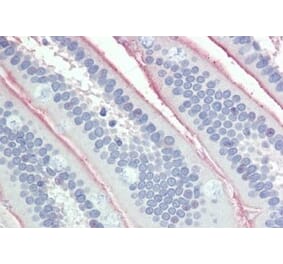 Immunohistochemistry - Anti-Intestinal Alkaline Phosphatase Antibody (A326257) - Antibodies.com