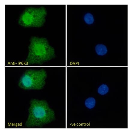 Immunofluorescence - Anti-IP6K3 Antibody (A326258) - Antibodies.com