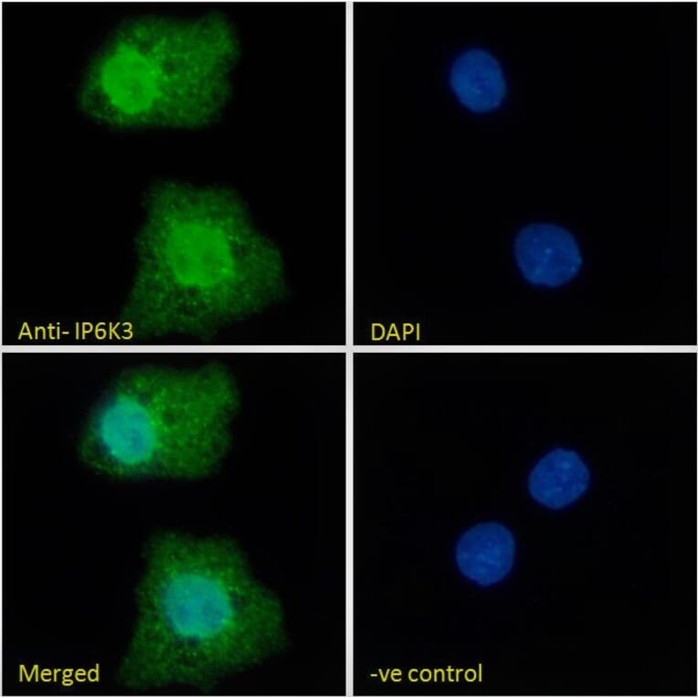 Immunofluorescence - Anti-IP6K3 Antibody (A326258) - Antibodies.com