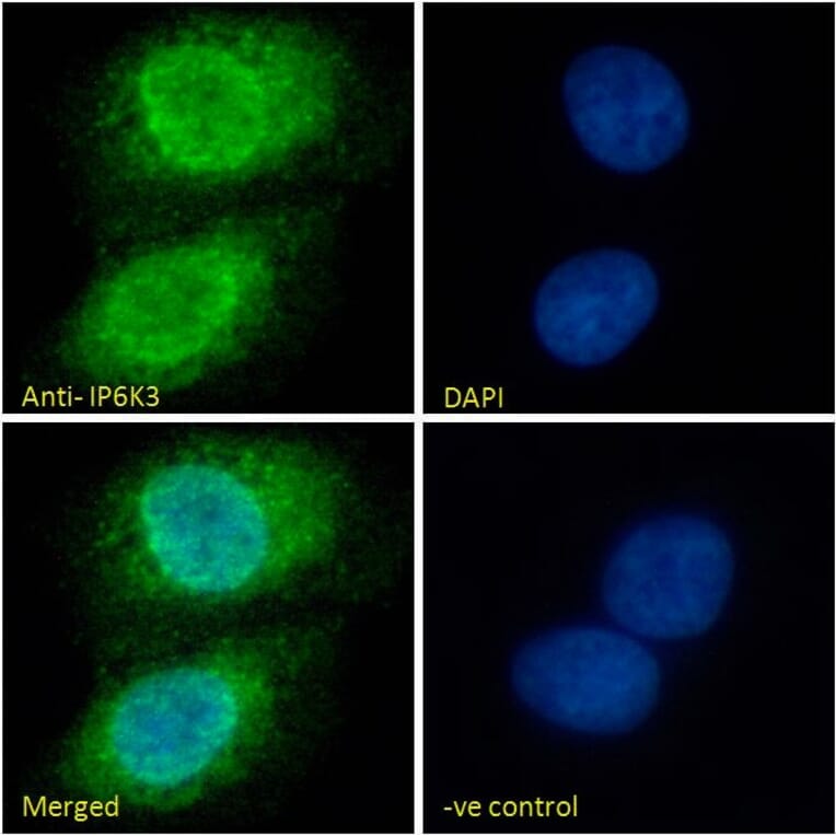 Immunofluorescence - Anti-IP6K3 Antibody (A326258) - Antibodies.com
