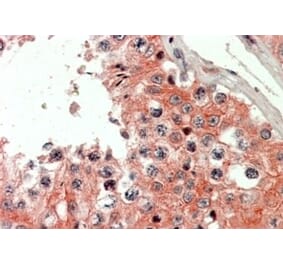 Immunohistochemistry - Anti-IQGAP2 Antibody (A326259) - Antibodies.com