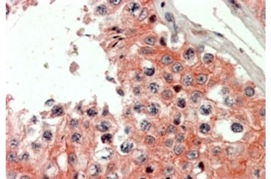 Immunohistochemistry - Anti-IQGAP2 Antibody (A326259) - Antibodies.com