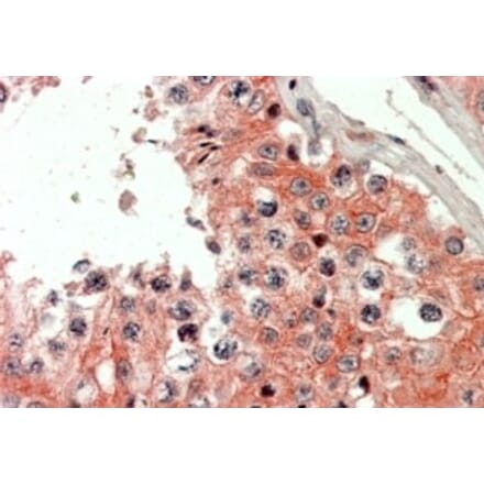 Immunohistochemistry - Anti-IQGAP2 Antibody (A326259) - Antibodies.com