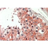 Immunohistochemistry - Anti-IQGAP2 Antibody (A326259) - Antibodies.com