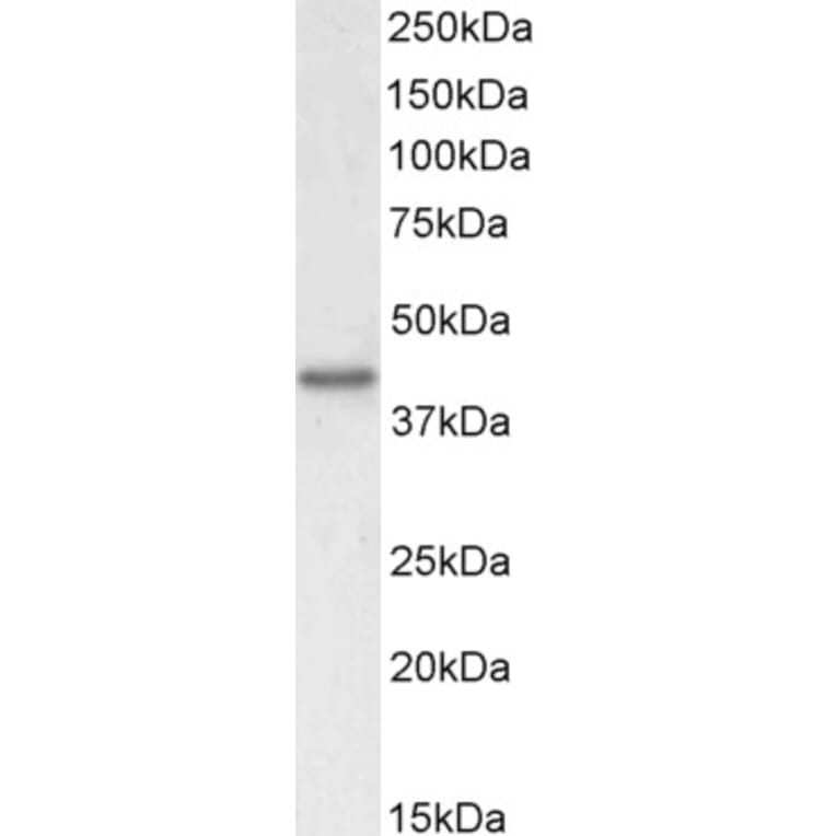 Western Blot - Anti-KLF2 Antibody (A326260) - Antibodies.com