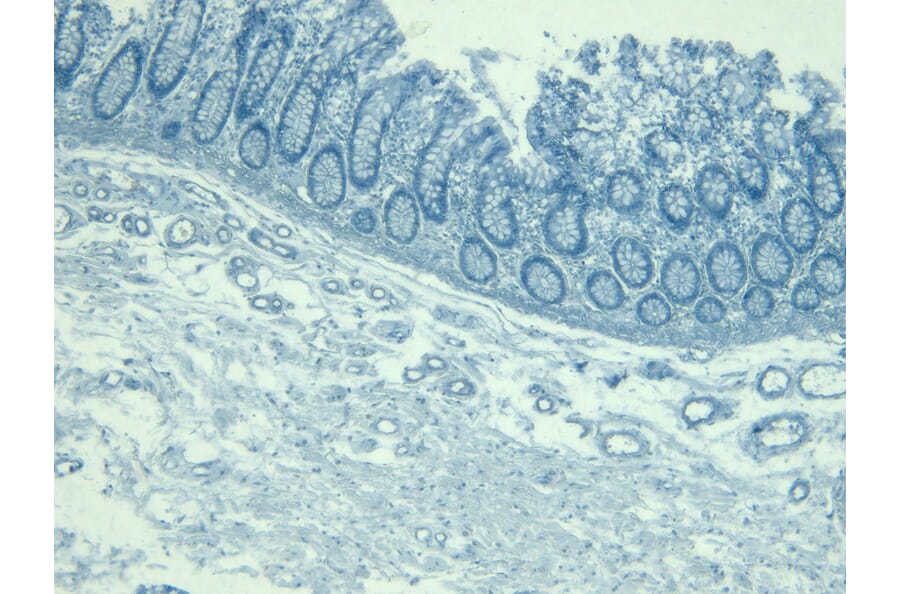 Immunohistochemistry - Anti-KLF2 Antibody (A326260) - Antibodies.com
