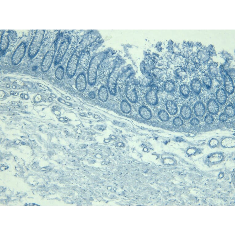 Immunohistochemistry - Anti-KLF2 Antibody (A326260) - Antibodies.com