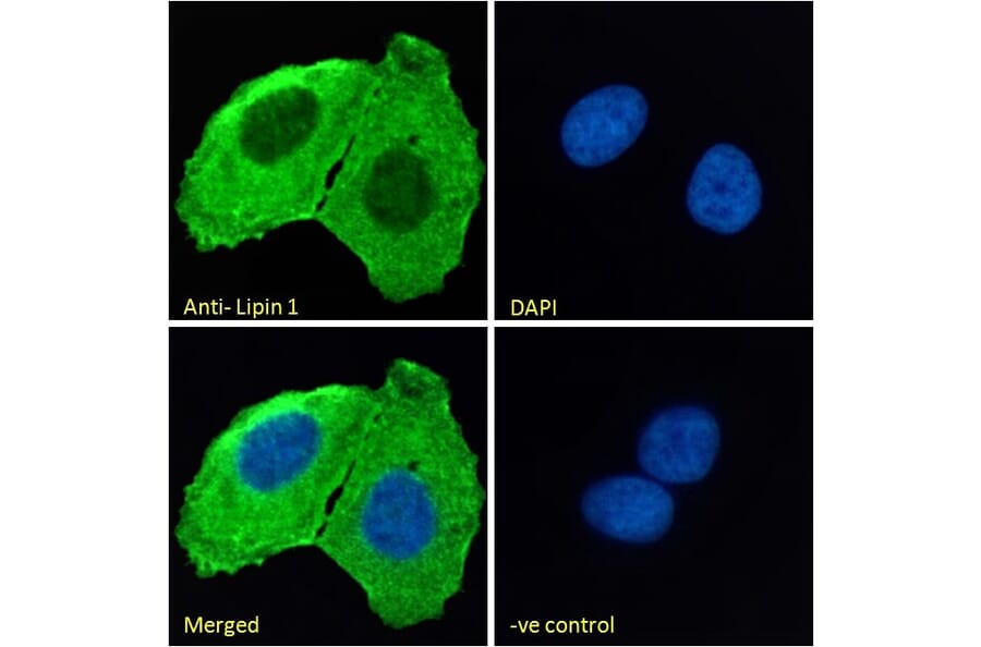 Immunofluorescence - Anti-Lipin 1 Antibody (A326261) - Antibodies.com
