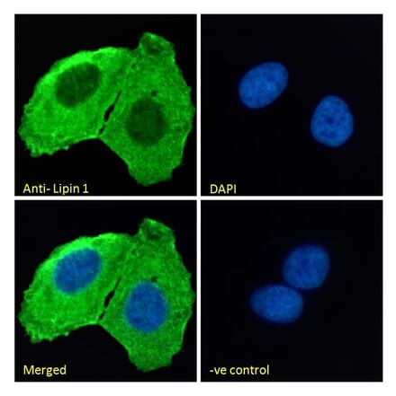 Immunofluorescence - Anti-Lipin 1 Antibody (A326261) - Antibodies.com