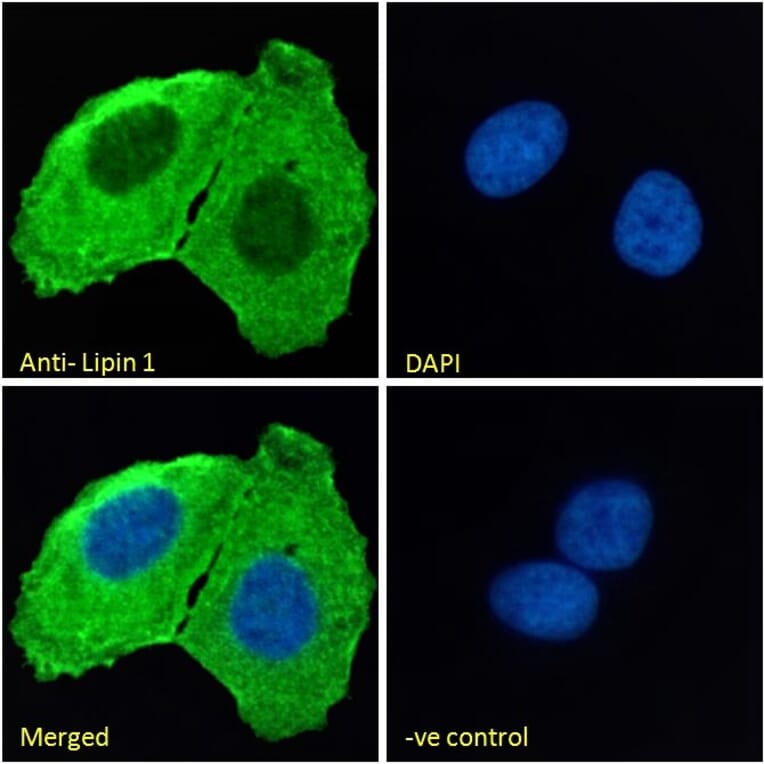 Immunofluorescence - Anti-Lipin 1 Antibody (A326261) - Antibodies.com
