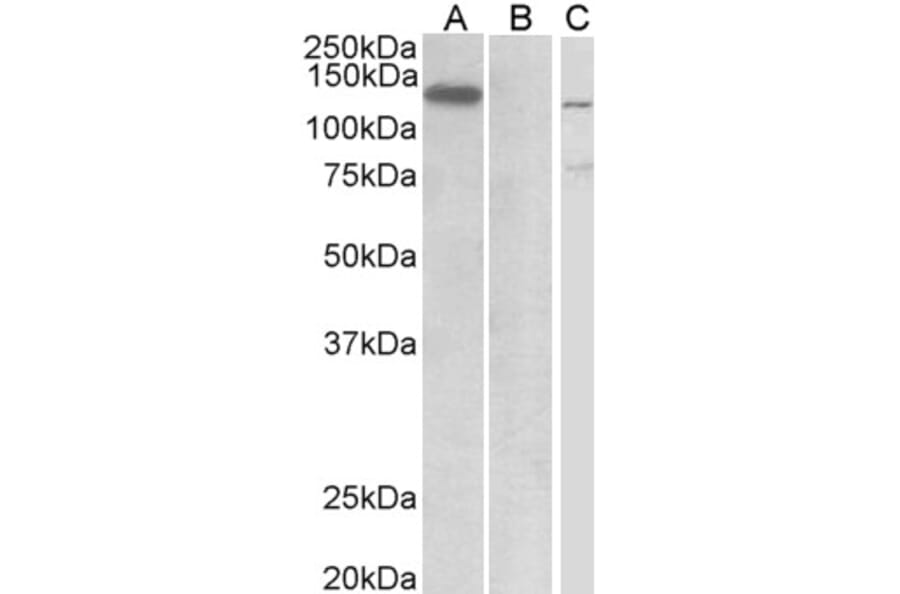 Western Blot - Anti-Mib1/Mindbomb Antibody (A326263) - Antibodies.com