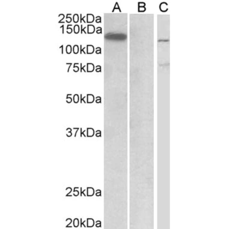 Western Blot - Anti-Mib1/Mindbomb Antibody (A326263) - Antibodies.com