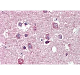 Immunohistochemistry - Anti-Nogo A Antibody (A326267) - Antibodies.com