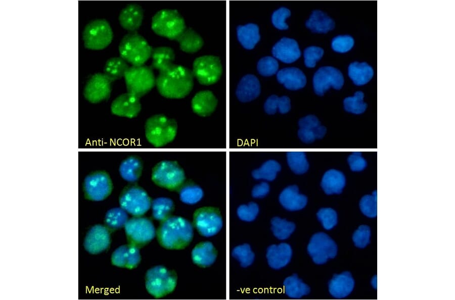 Immunofluorescence - Anti-NCOR1 Antibody (A326268) - Antibodies.com