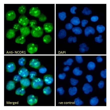 Immunofluorescence - Anti-NCOR1 Antibody (A326268) - Antibodies.com