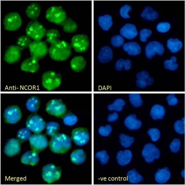 Immunofluorescence - Anti-NCOR1 Antibody (A326268) - Antibodies.com