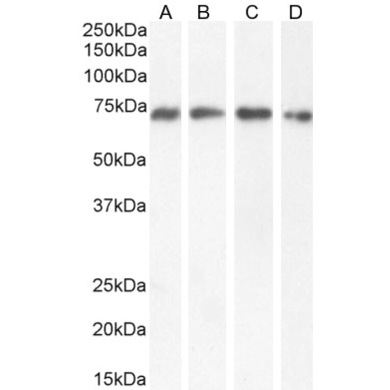 Western Blot - Anti-Nucleoporin p62 Antibody (A326269) - Antibodies.com