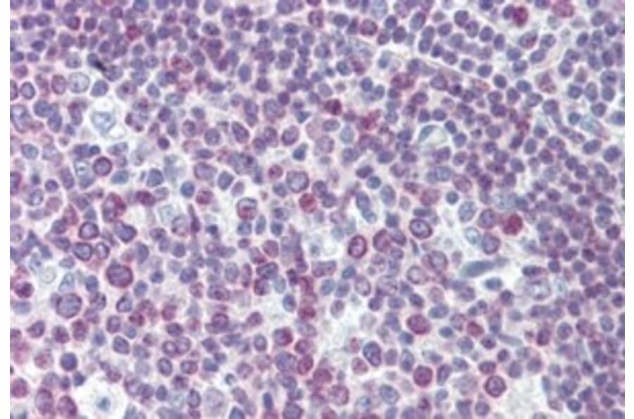 Immunohistochemistry - Anti-PAX7 Antibody (A326272) - Antibodies.com