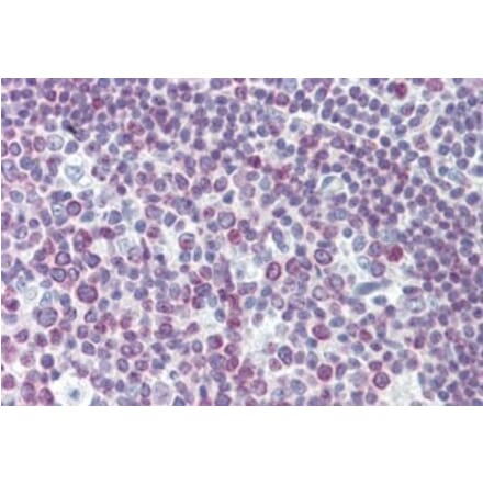 Immunohistochemistry - Anti-PAX7 Antibody (A326272) - Antibodies.com