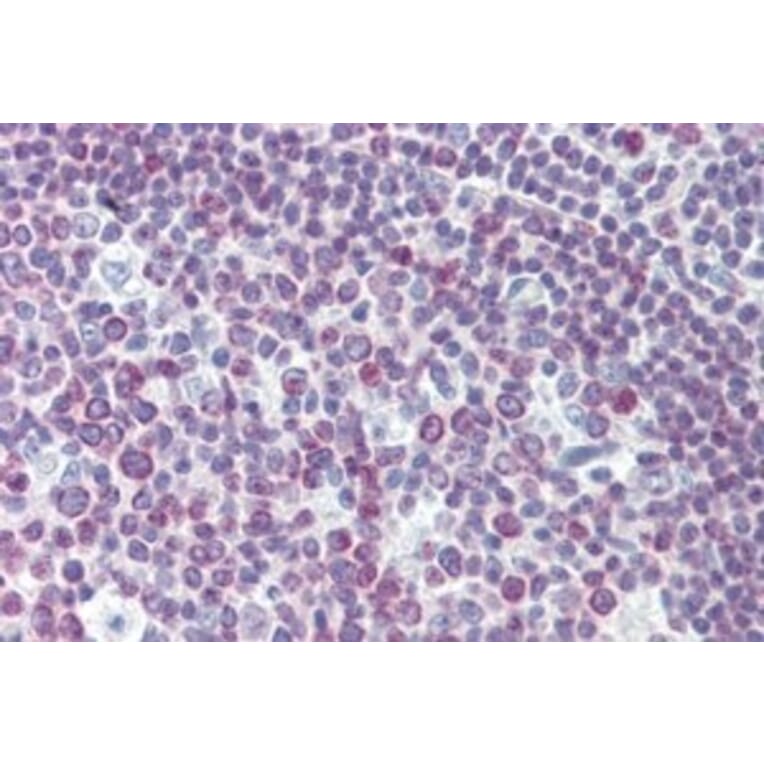 Immunohistochemistry - Anti-PAX7 Antibody (A326272) - Antibodies.com
