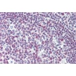 Immunohistochemistry - Anti-PAX7 Antibody (A326272) - Antibodies.com