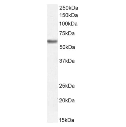 Western Blot - Anti-Perilipin-1 Antibody (A326274) - Antibodies.com