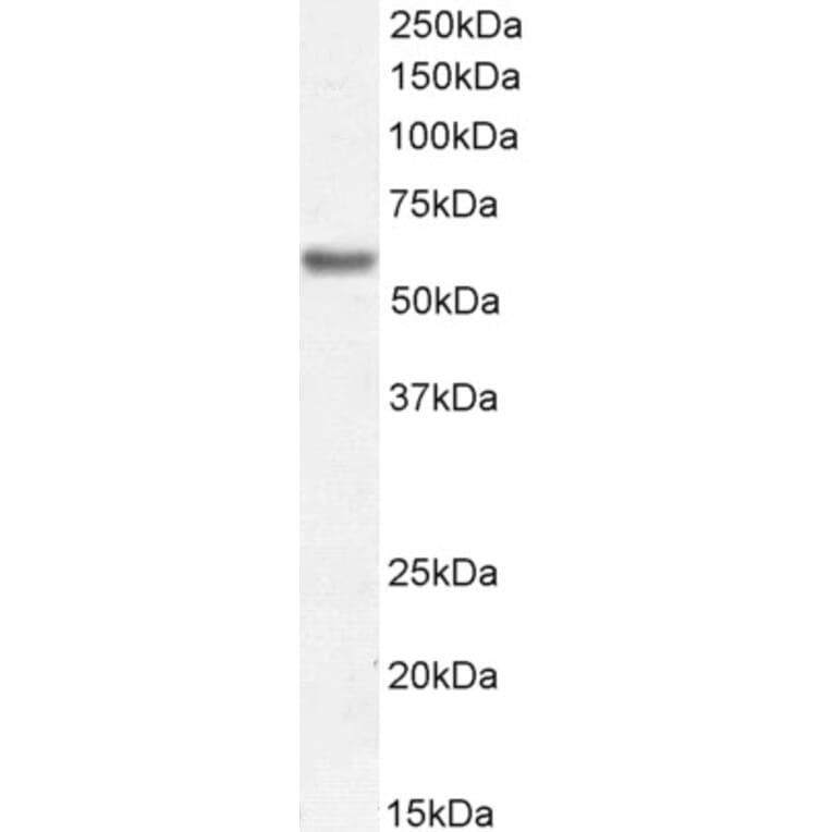 Western Blot - Anti-Perilipin-1 Antibody (A326274) - Antibodies.com