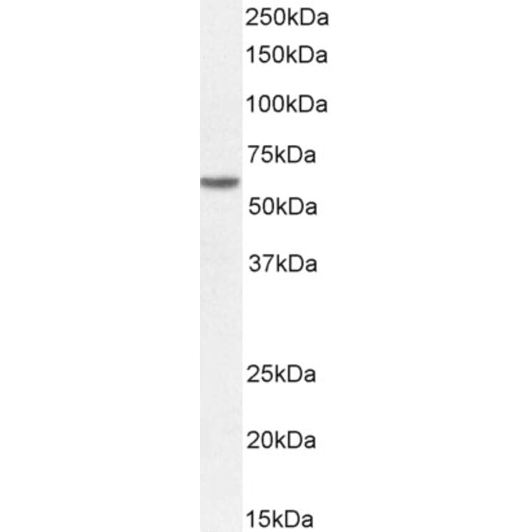 Western Blot - Anti-Perilipin-1 Antibody (A326275) - Antibodies.com