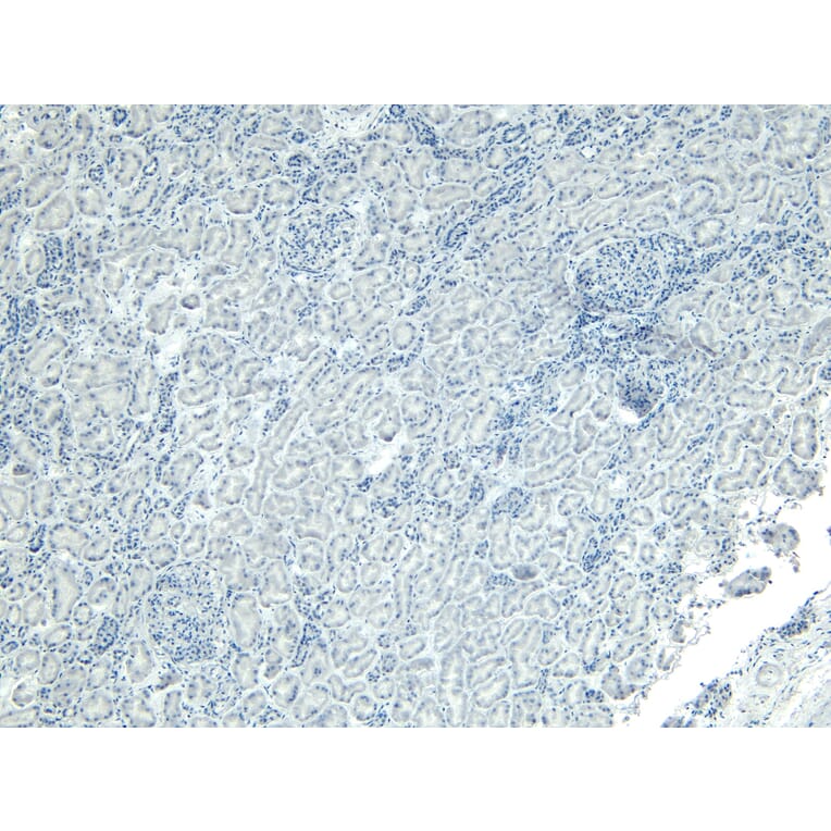 Immunohistochemistry - Anti-PGC1 alpha Antibody (A326276) - Antibodies.com