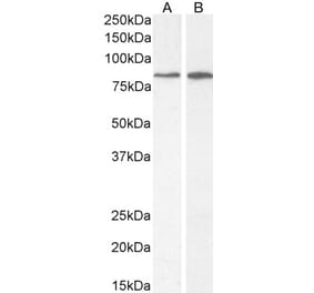 Western Blot - Anti-PLC-delta-3 Antibody (A326279) - Antibodies.com