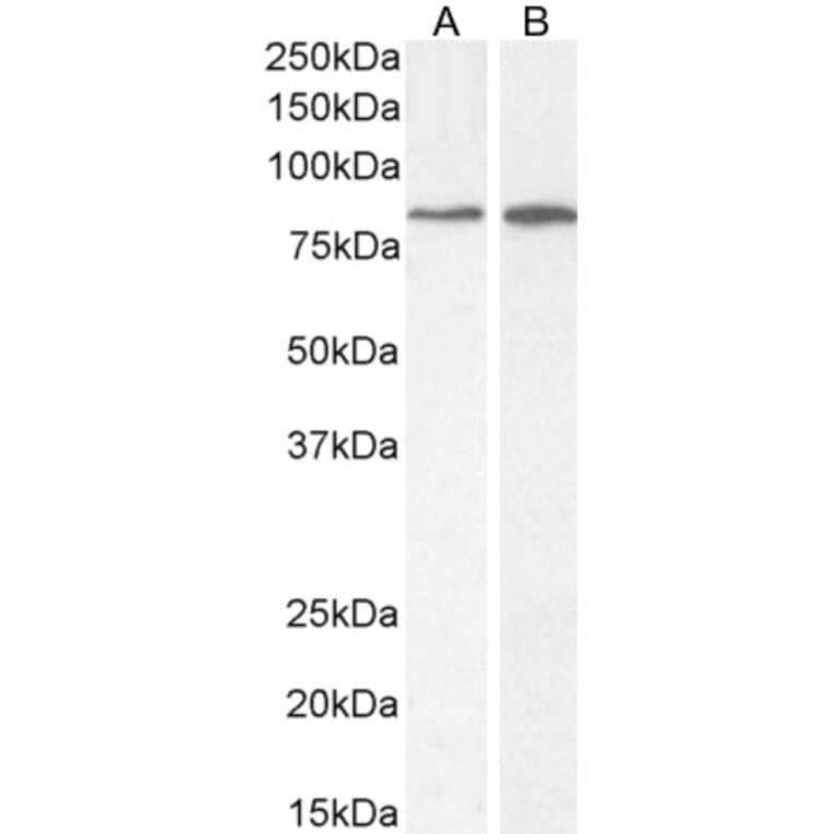 Western Blot - Anti-PLC-delta-3 Antibody (A326279) - Antibodies.com