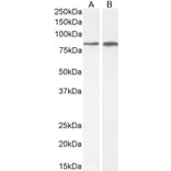 Western Blot - Anti-PLC-delta-3 Antibody (A326279) - Antibodies.com